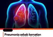 DOSM: Pneumonia overtakes heart disease as Malaysia’s top cause of death in 2023