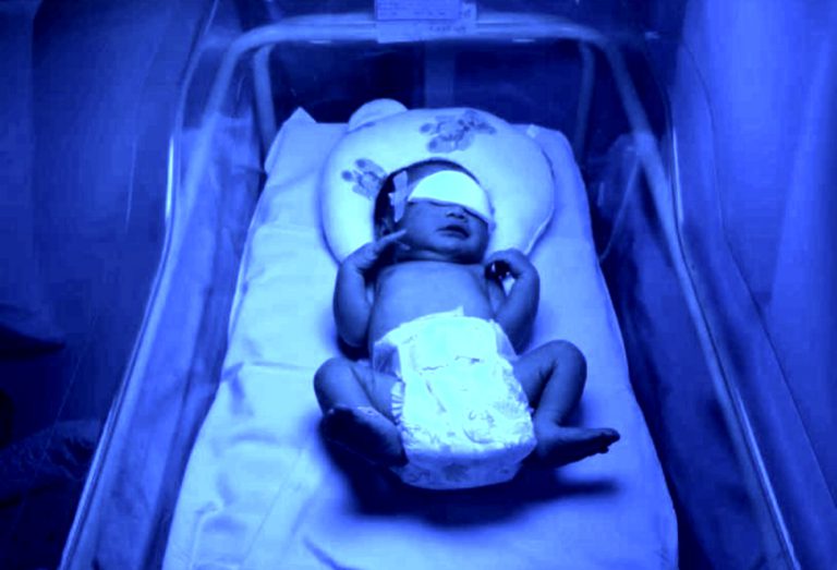 Susu Kambing Bukan Rawatan Untuk Kuning (Neonatal Jaundis)