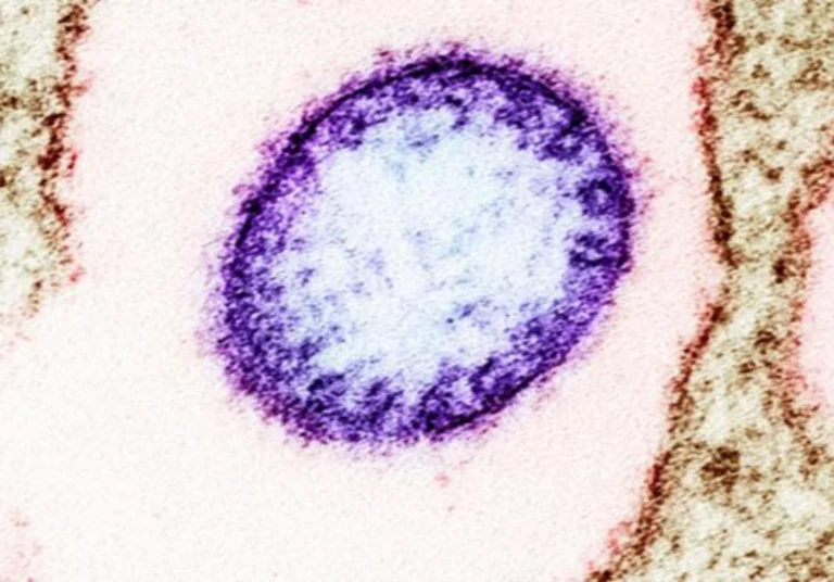 Waspada Wabak Nipah